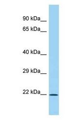 IL28B antibody Western Blot of Fetal Lung. Antibody dilution: 1 ug/ml.