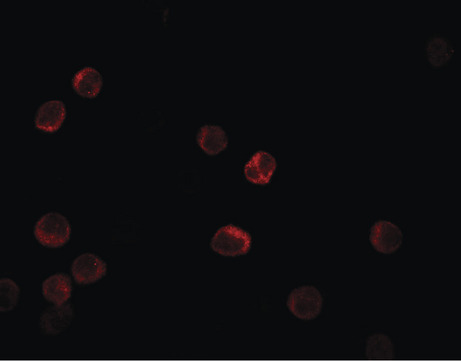 Immunofluorescence of IL-28B in HeLa cells with IL-28B antibody at 5 ug/ml.