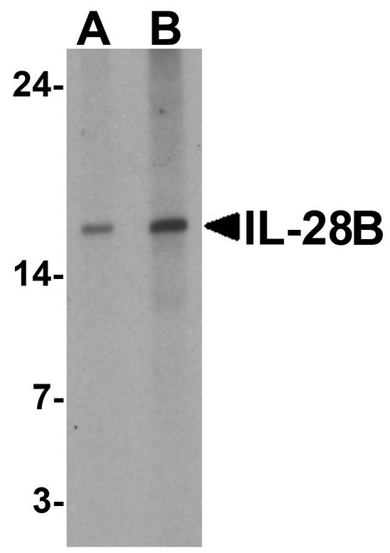 Western blot analysis of IL-28B in HeLa cell lysate with IL-28B antibody at (A) 1 and (B) 2 ug/ml.