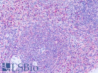 Anti-GPR63 antibody IHC of human spleen. Immunohistochemistry of formalin-fixed, paraffin-embedded tissue after heat-induced antigen retrieval. Antibody LS-A6354 dilution 6-11 ug/ml.