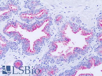 Anti-GPR63 antibody IHC of human prostate. Immunohistochemistry of formalin-fixed, paraffin-embedded tissue after heat-induced antigen retrieval. Antibody LS-A6354 dilution 6-11 ug/ml.