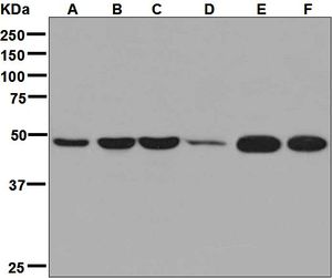 Western blot analysis on (A) fetal brain, (B) SH-SY5Y, (C) U87-MG, (D) human hypothalamus, (E) Neuro-2a, and (F) C6 lysates using anti-GPR63 antibody.
