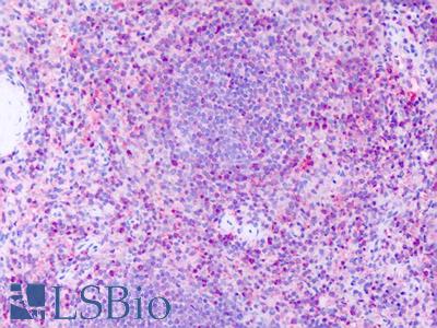 Anti-GPR63 antibody IHC of human spleen. Immunohistochemistry of formalin-fixed, paraffin-embedded tissue after heat-induced antigen retrieval. Antibody LS-A6357 dilution 19 ug/ml.