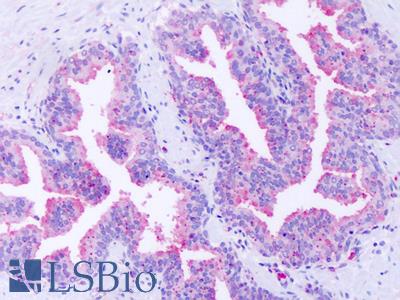 Anti-GPR63 antibody IHC of human prostate. Immunohistochemistry of formalin-fixed, paraffin-embedded tissue after heat-induced antigen retrieval. Antibody LS-A6357 dilution 19 ug/ml.