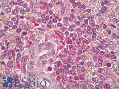 Anti-IL2RB / CD122 antibody IHC of human spleen, periarterial lymphocytes. Immunohistochemistry of formalin-fixed, paraffin-embedded tissue after heat-induced antigen retrieval. Antibody LS-B7003 concentration 15 ug/ml.