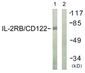 Western blot of extracts from COS7 cells, using IL-2R beta/CD122 antibody. The lane on the right is treated with the synthesized peptide.