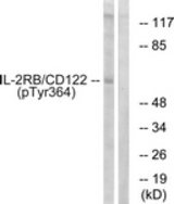 Western blot of extracts from COS7 cells, using IL-2R beta/CD122 (Phospho-Tyr364) Antibody. The lane on the right was incubated with synthetic peptide.