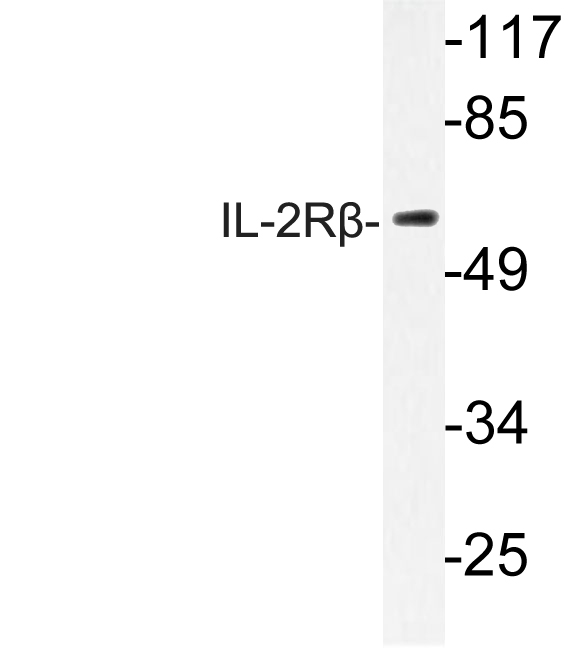 Western blot of IL-2R beta antibody in extracts from RAW264.7 cells.