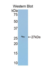 Western blot of recombinant IL2RB / CD122.