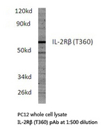 Western blot of IL-2R (T360) pAb in extracts from PC12 cells.