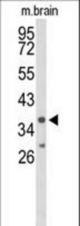 Western blot of IL2RG Antibody in mouse brain tissue lysates (35 ug/lane). IL2RG (arrow) was detected using the purified antibody.