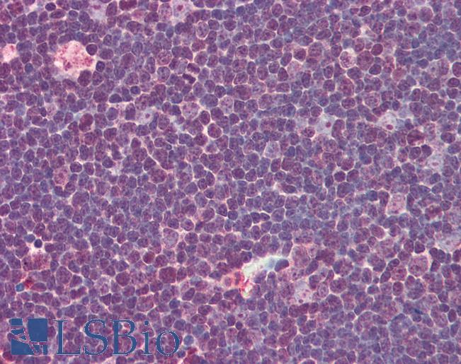 Anti-IL-31 antibody IHC of human thymus. Immunohistochemistry of formalin-fixed, paraffin-embedded tissue after heat-induced antigen retrieval. Antibody LS-B575 concentration 5 ug/ml.