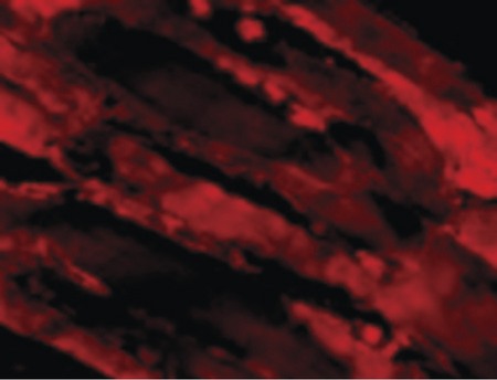 Immunofluorescence of IL-31 in Human Skeletal Muscle cells with IL-31 antibody at 20 ug/ml.