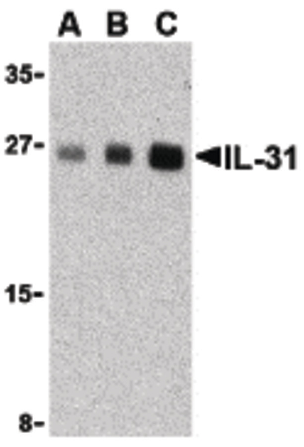 Western blot of IL-31 in human skeletal muscle tissue lysate with IL-31 antibody at (A) 2.5, (B) 5 and (C) 10 ug/ml.