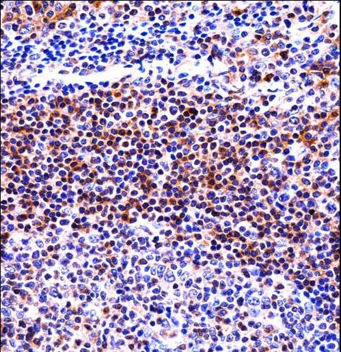 IL32 Antibody immunohistochemistry of formalin-fixed and paraffin-embedded human tonsil tissue followed by peroxidase-conjugated secondary antibody and DAB staining.