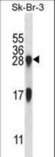 IL32 Antibody western blot of SK-BR-3 cell line lysates (35 ug/lane). The IL32 antibody detected the IL32 protein (arrow).