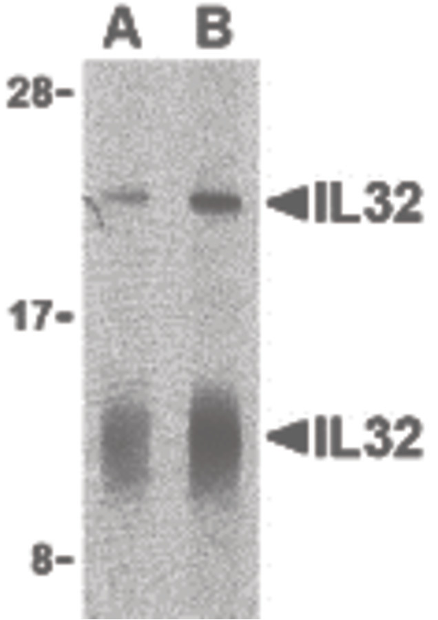 Western blot of IL-32 in human spleen lysate with IL-32 antibody at (A) 5 and (B) 10 ug/ml shows two isoforms of IL-32.
