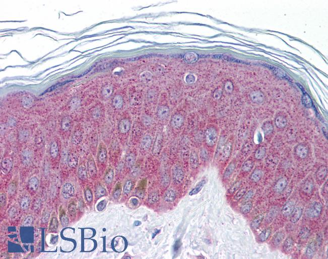 Anti-IL-33 antibody IHC of human skin. Immunohistochemistry of formalin-fixed, paraffin-embedded tissue after heat-induced antigen retrieval. Antibody LS-B5822 concentration 5 ug/ml.
