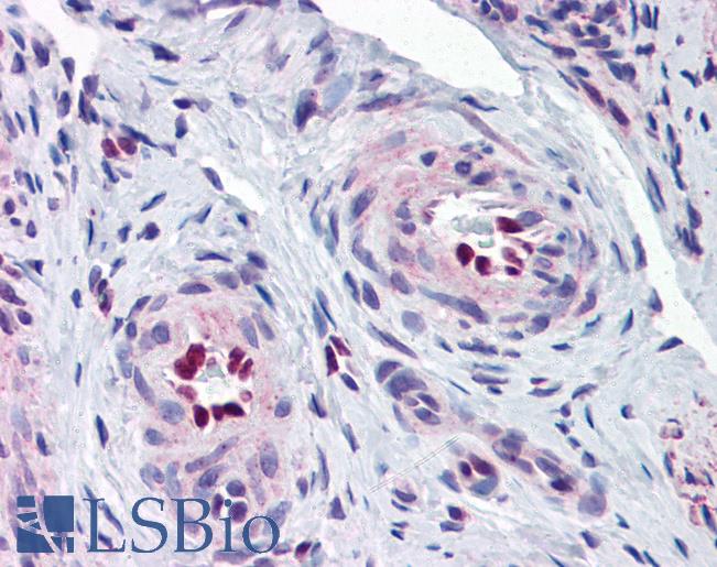 Anti-IL-33 antibody IHC of human uterus, vessels. Immunohistochemistry of formalin-fixed, paraffin-embedded tissue after heat-induced antigen retrieval. Antibody LS-B2713 concentration 5 ug/ml.