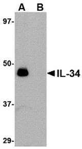 Western blot of IL-34 in human brain tissue lysate with IL-34 antibody at 0.25 ug/ml in (A) the absence and (B) the presence of blocking peptide.