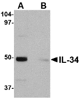 Western blot of IL-34 in human brain tissue lysate with IL-34 antibody at 0.25 ug/ml in (A) the absence and (B) the presence of blocking peptide.