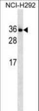 IL34 Antibody western blot of NCI-H292 cell line lysates (35 ug/lane). The IL34 antibody detected the IL34 protein (arrow).