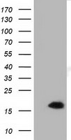 HEK293T cells were transfected with the pCMV6-ENTRY control (Left lane) or pCMV6-ENTRY IL1F6 (Right lane) cDNA for 48 hrs and lysed. Equivalent amounts of cell lysates (5 ug per lane) were separated by SDS-PAGE and immunoblotted with anti-IL1F6.