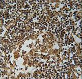 IL1F6 Antibody immunohistochemistry of formalin-fixed and paraffin-embedded human lymph tissue followed by peroxidase-conjugated secondary antibody and DAB staining.