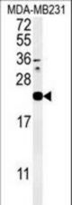 Western blot of IL1F6 Antibody in MDA-MB231 cell line lysates (35 ug/lane). IL1F6 (arrow) was detected using the purified antibody.