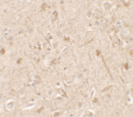 Immunohistochemistry of IL-36A in human brain tissue with IL-36A antibody at 5 ug/ml.