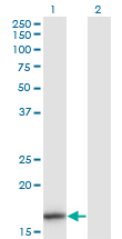 Western blot of IL1F8 expression in transfected 293T cell line by IL1F8 monoclonal antibody (M01), clone 1E4.