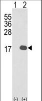 Western blot of IL1F8 (arrow) using rabbit polyclonal IL1F8 Antibody. 293 cell lysates (2 ug/lane) either nontransfected (Lane 1) or transiently transfected with the IL1F8 gene (Lane 2).