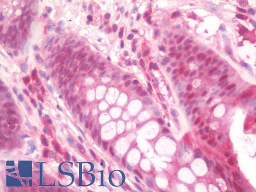 Anti-IL36B antibody IHC staining of human colon. Immunohistochemistry of formalin-fixed, paraffin-embedded tissue after heat-induced antigen retrieval. Antibody LS-B10136 concentration 10 ug/ml.