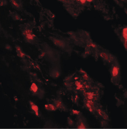 Immunofluorescence of IL-36B in human lung tissue with IL-36B antibody at 20 ug/ml.