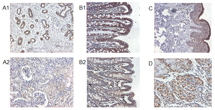 Immunohistochemical staining of IL-37 in human kidney (A1), human colon (B1), human skin (C) and human stomach (D) using anti-IL-37 . Human kidney (A2) and human colon (B2) are stained with negative control anti-rabbit IgG.