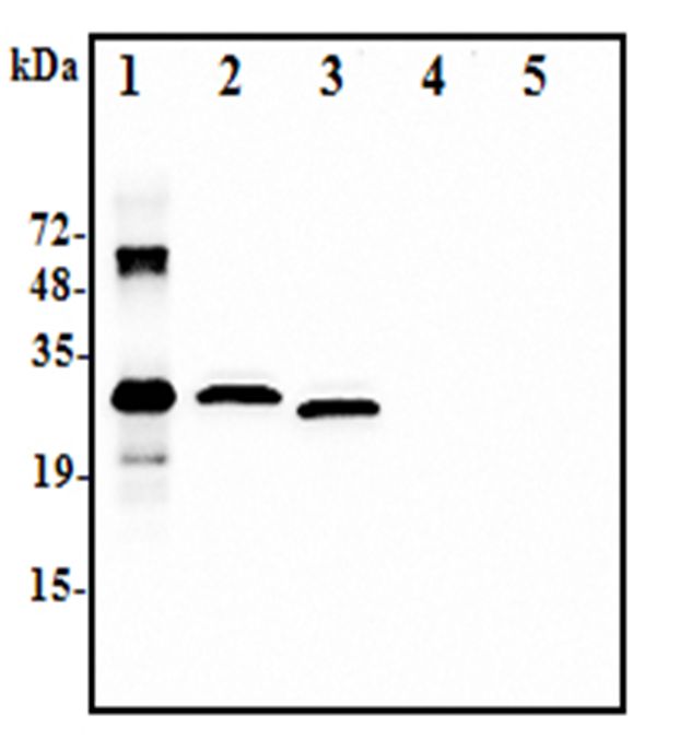 Western blot analysis using anti-IL-37 (human), pAb at 1:2.000 dilution:.1. Recombinant human IL-37-His (50ng).2. Human IL-37-FLAG transfected HEK293 cell lysate(100microg).3. Human IL-37-tag free transfected HEK293 cell lysate(100microg).4. Empty vector transfected HEK293 cell lysate(100microg).5. A unrelated protein-His (50ng)