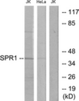 Western blot of extracts from Jurkat/HeLa cells, using SPR1 Antibody. The lane on the right is treated with the synthesized peptide.
