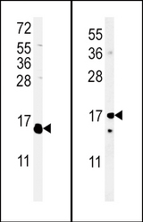 (LEFT)Western blot of IL4 Antibody in WiDr cell line lysates (35 ug/lane). IL4 (arrow) was detected using the purified antibody.(RIGHT)Western blot of IL4 Antibody in mouse cerebellum cell line lysates (35 ug/lane). IL4(arrow) was detected using the purified antibody.