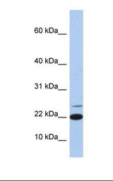 Hela cell lysate. Antibody concentration: 1.0 ug/ml. Gel concentration: 10-20%.
