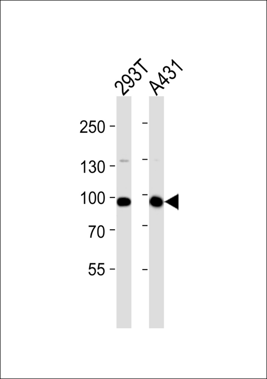 Western blot of lysates from 293T, A431 cell line (from left to right) with IL4R Antibody. Antibody was diluted at 1:1000 at each lane. A goat anti-rabbit IgG H&L (HRP) at 1:5000 dilution was used as the secondary antibody. Lysates at 35 ug per lane.