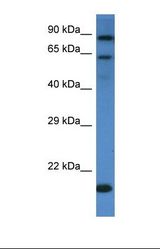 Western blot of Human HCT15 Whole Cell. IL4R antibody dilution 1.0 ug/ml.