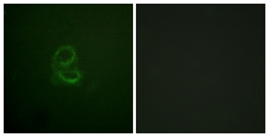 Immunofluorescence of A549 cells, using IL-4R/CD124 (Ab-497) Antibody. The picture on the right is treated with the synthesized peptide.