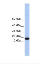 Hela cell lysate. Antibody concentration: 1.0 ug/ml. Gel concentration: 10-20%.