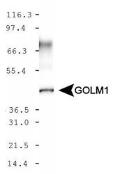 GOLPH2 Antibody - WB detection of GOLM1 in HeLa whole cell extract.