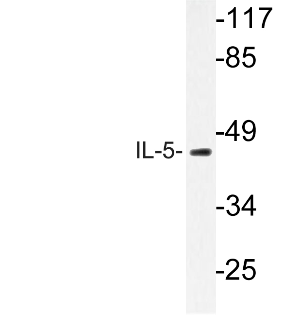 Western blot of IL-5 (S92) pAb in extracts from HT-29 cells.