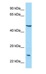 IL5RA / CD125 antibody Western Blot of MCF7.