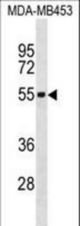 IL5RA Antibody western blot of MDA-MB453 cell line lysates (35 ug/lane). The IL5RA antibody detected the IL5RA protein (arrow).