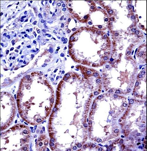 IL6 Antibody immunohistochemistry of formalin-fixed and paraffin-embedded human kidney tissue followed by peroxidase-conjugated secondary antibody and DAB staining.