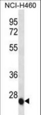 IL6 Antibody western blot of NCI-H460 cell line lysates (35 ug/lane). The IL6 antibody detected the IL6 protein (arrow).
