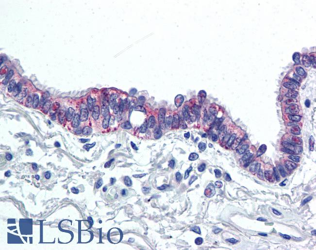 Anti-IL-6 antibody LS-A9692 IHC of human lung, respiratory epithelium. Immunohistochemistry of formalin-fixed, paraffin-embedded tissue after heat-induced antigen retrieval.
